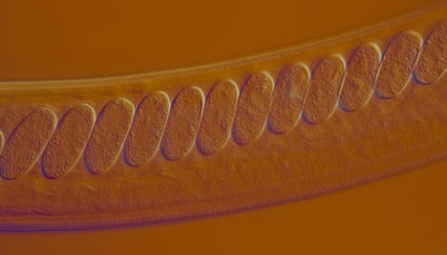 image of Cooperia oncophora adult female eggs