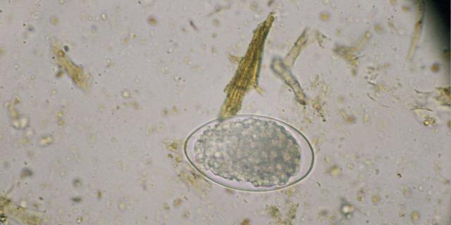 image of nematode egg