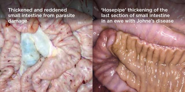 two side-by-side images of thickened intestines