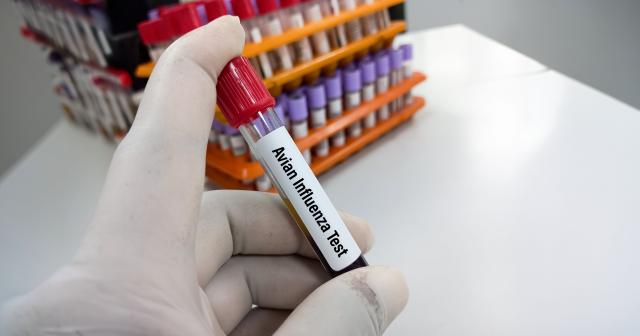 image of bird test tube